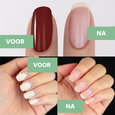 Sylvia | Magische nagellak Verwijderaar 1+1 GRATIS